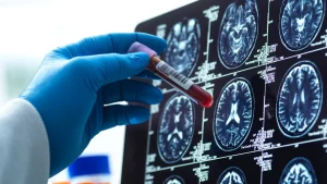 Análisis de sangre para detectar el Alzheimer: